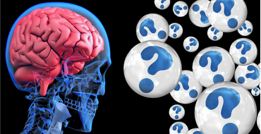 مراحل تطور مرض ألزهايمر 